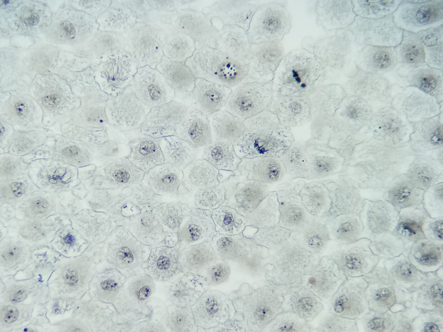 White Fish Mitosis Slides - White Fish Mitosis 01 400X